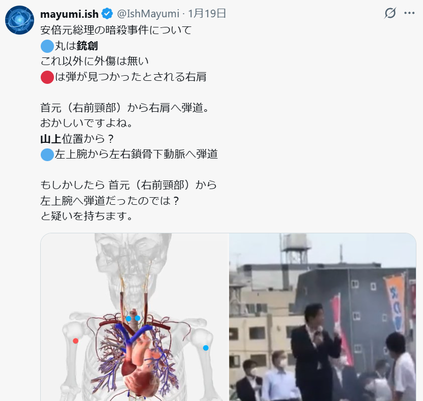 山上徹也被告が「起訴状記載の事実を認める」　安倍元総理銃撃事件「法律上どうなるかは弁護人に任せる」弁護側も殺人罪成立認める　