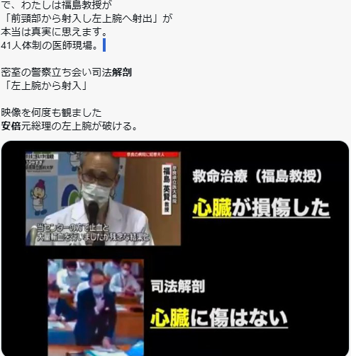 山上徹也被告が「起訴状記載の事実を認める」　安倍元総理銃撃事件「法律上どうなるかは弁護人に任せる」弁護側も殺人罪成立認める　