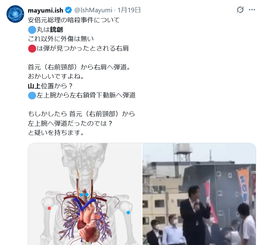 山上徹也被告が「起訴状記載の事実を認める」　安倍元総理銃撃事件「法律上どうなるかは弁護人に任せる」弁護側も殺人罪成立認める　