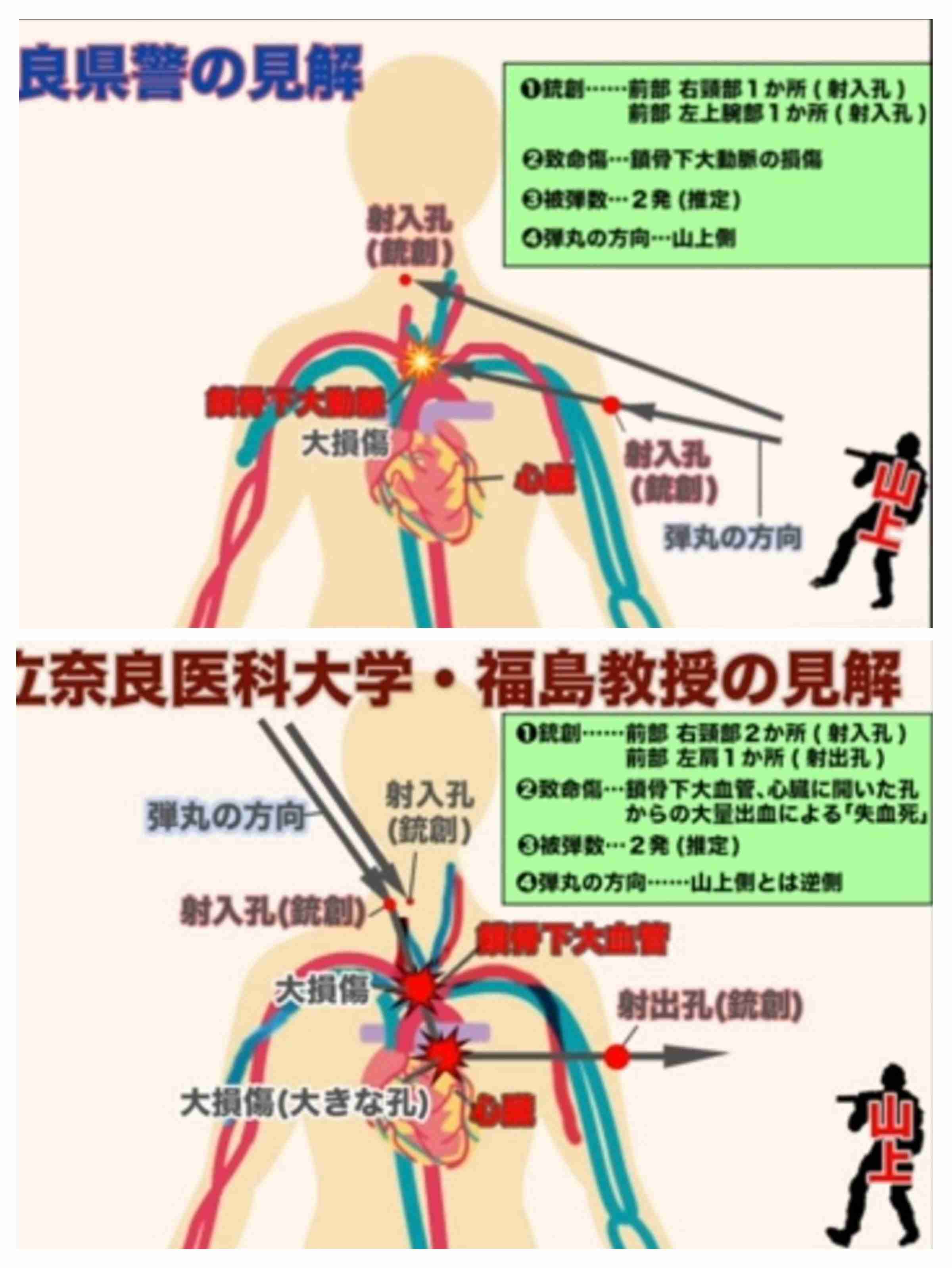山上徹也被告が「起訴状記載の事実を認める」　安倍元総理銃撃事件「法律上どうなるかは弁護人に任せる」弁護側も殺人罪成立認める　