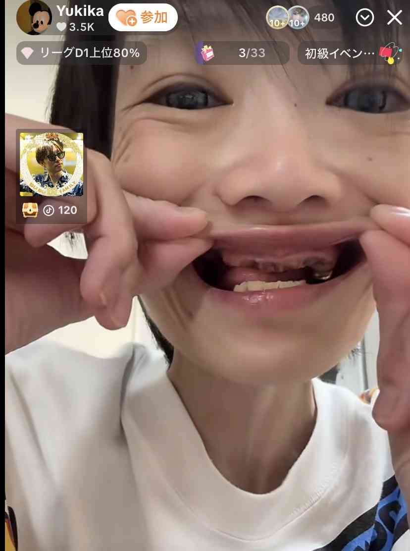 大食いYouTuber・はらぺこツインズ、活動休止を報告　小野あこ即時入院、小野かこ体調不良