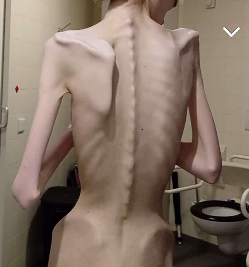 「間違えた痩せ方しないで！」　危機感抱く「ギャル筋肉看護学生」に称賛の声が続出