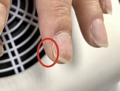 指のヒビ割れにオススメのハンドクリーム