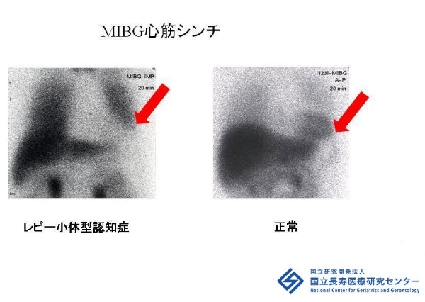 【悪夢】睡眠障害の方【叫ぶ】
