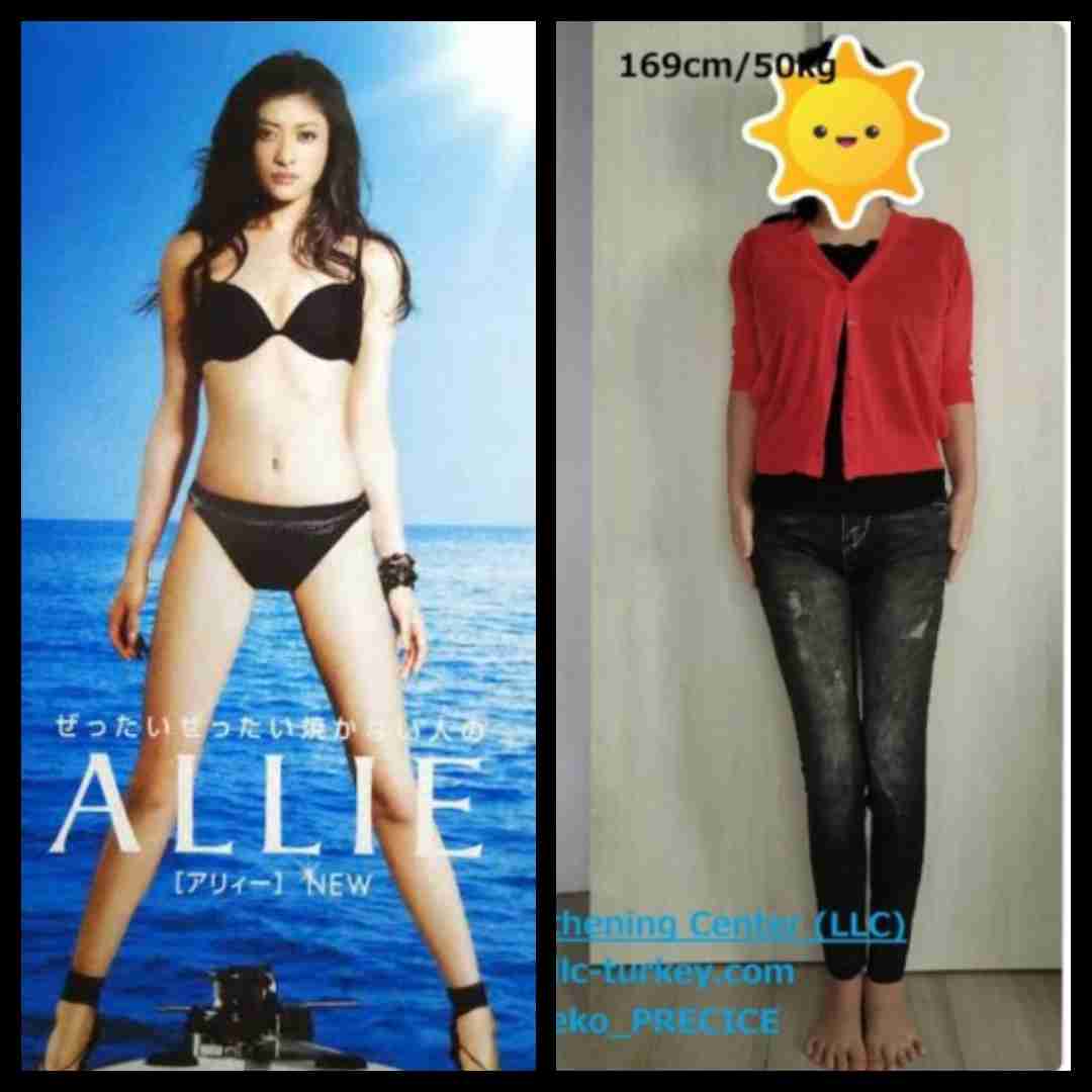 「歩けなくなるんじゃ…」〝韓国の脚痩せ整形〟ビフォーアフター写真にさまざまな声「老後大変そう」「心底やってよかった」「直後からこの変化！」
