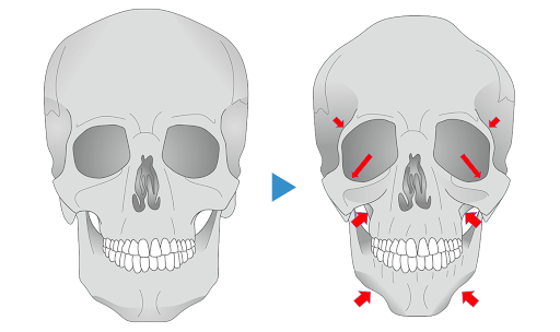 ほうれい線、弛みにおすすめの美容液