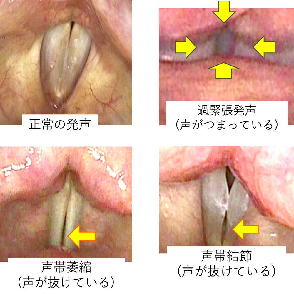 【ネタ注意】全くエロくないのにそういう風に見える画像を貼るトピ Part7