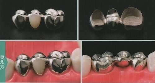 入れ歯の人いますか?