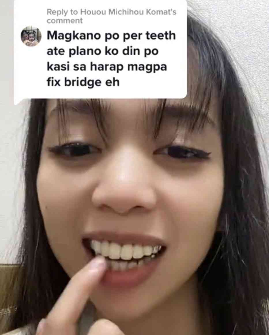 入れ歯の人いますか?