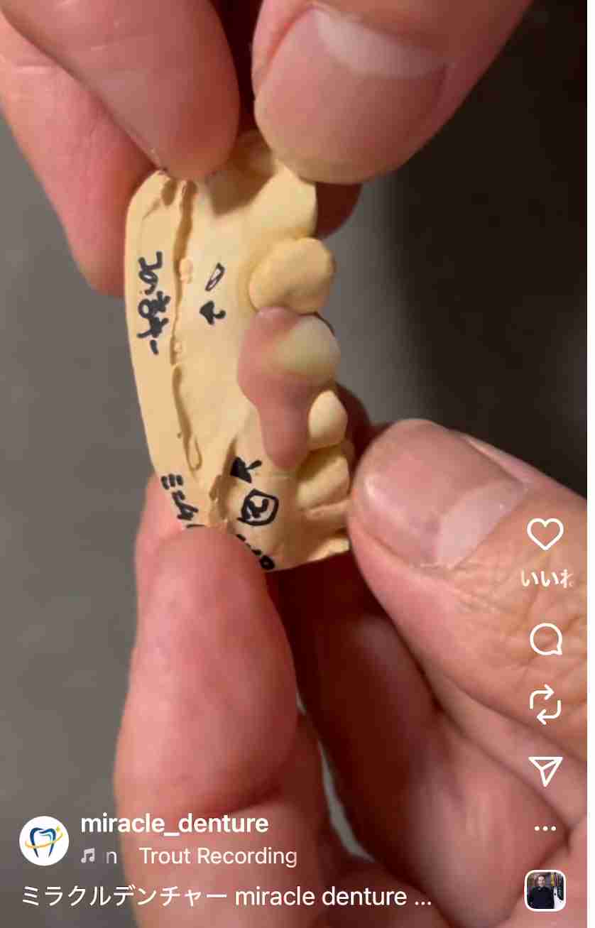 入れ歯の人いますか?