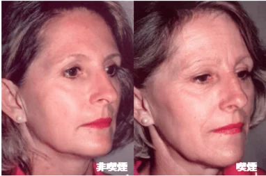 お酒とタバコをしない人、老けないですか？