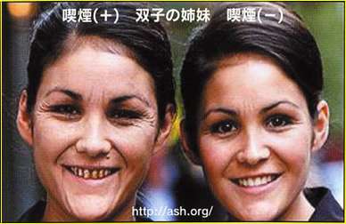 お酒とタバコをしない人、老けないですか？