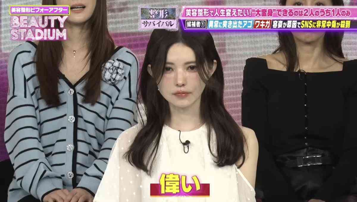 整形総額2600万円の平瀬あいり、“人生変わった”整形マップ公開 ネット驚き「めちゃくちゃ努力されたのですね」