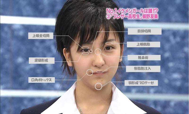 整形総額2600万円の平瀬あいり、“人生変わった”整形マップ公開 ネット驚き「めちゃくちゃ努力されたのですね」