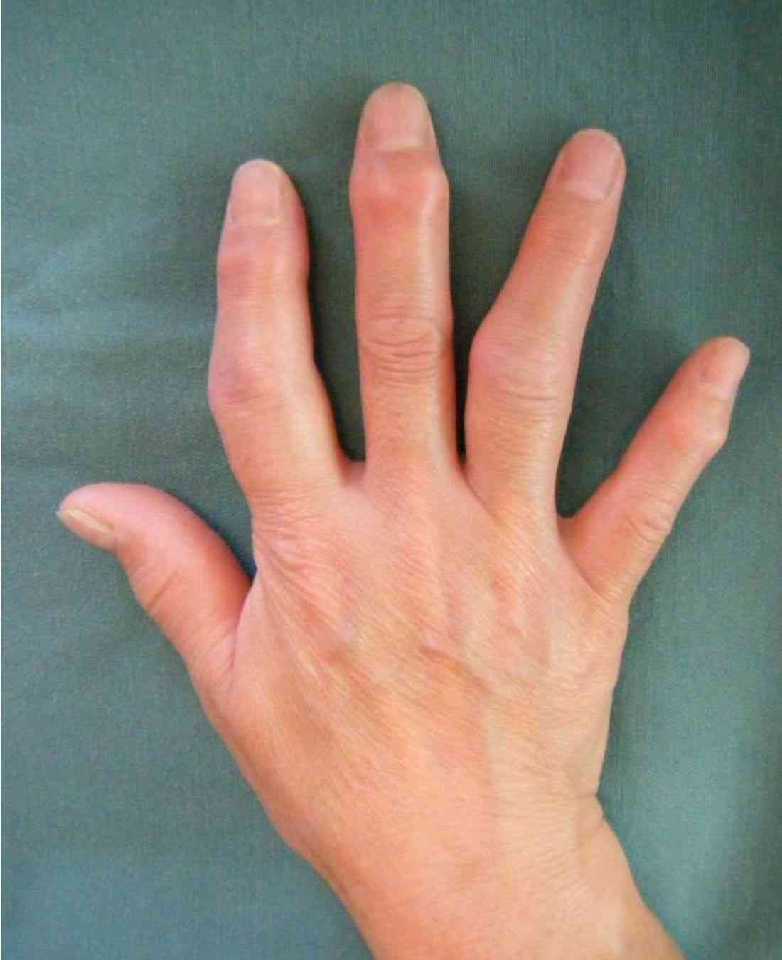 45歳前後の人〜更年期症状ありますか？