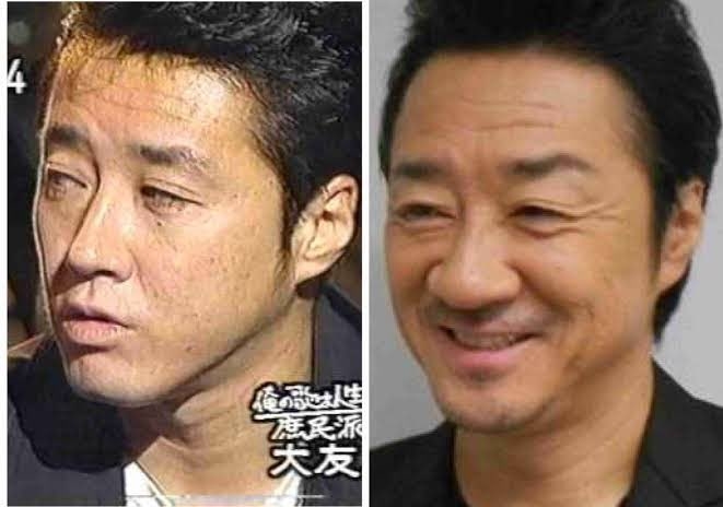 急に老けた所/部位