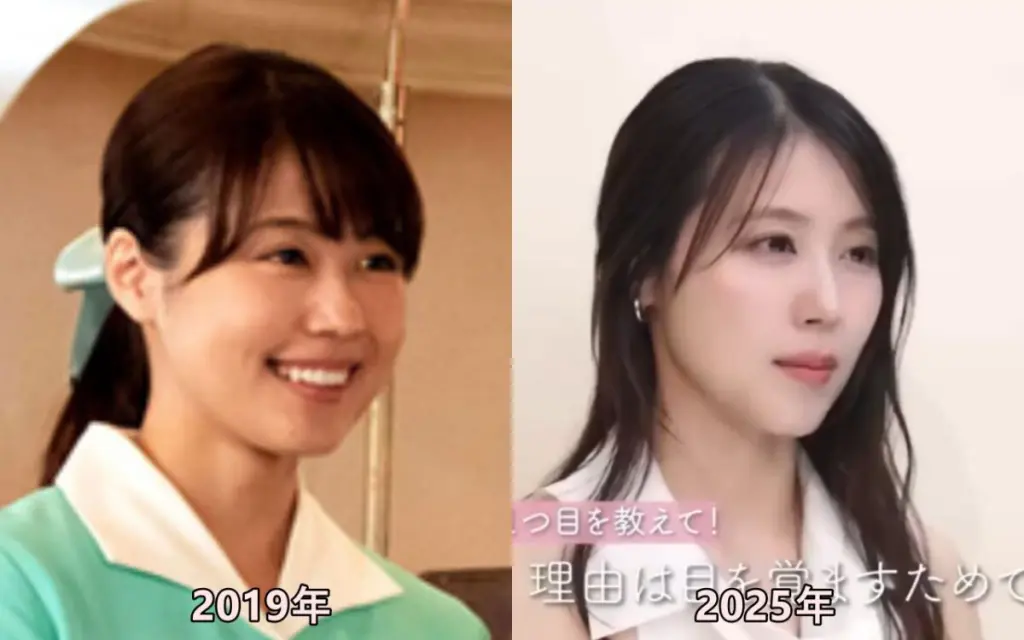 何歳からボトックス打つ？