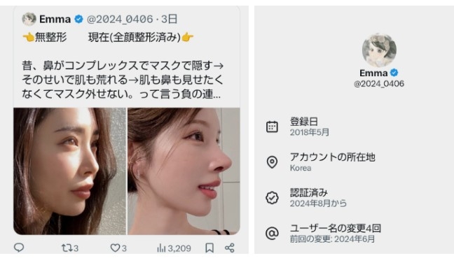 Xについて知ってること