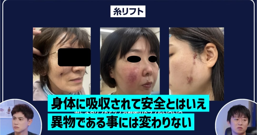 Xについて知ってること