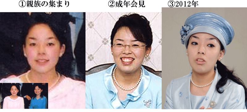 TPOは大事ですよね