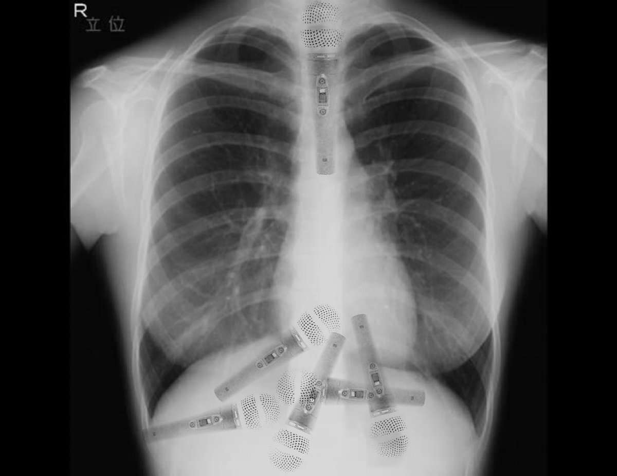 歌詞ではなく音楽で泣いた経験ある人