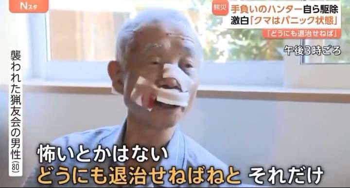 クマに顔引き裂かれ、神経・筋肉失い手術５回…後遺症に苦しむ男性「駆除しないと」「かわいそうとは思わないよ」　
