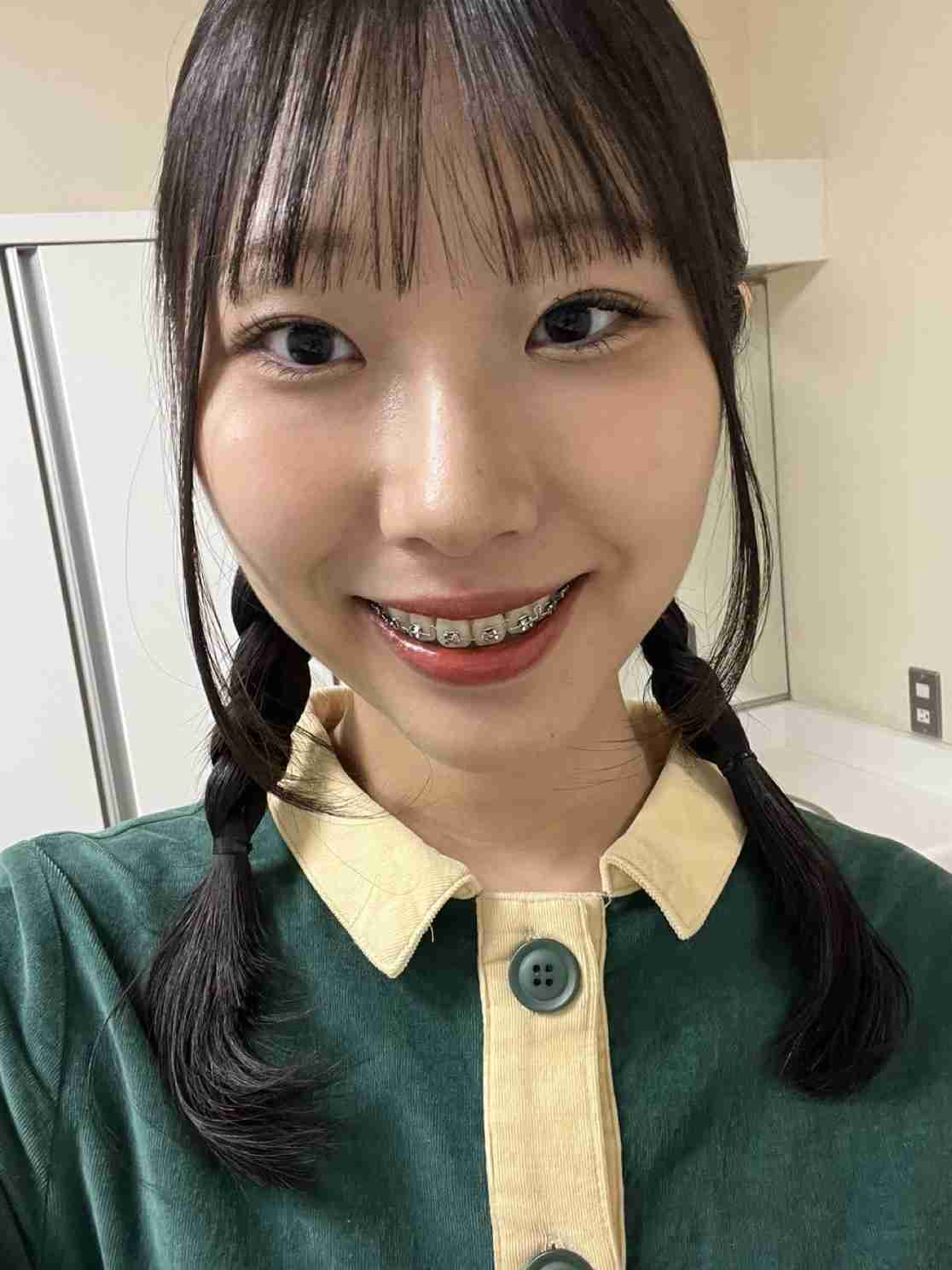 20代のうちにしておいた方がいい美容