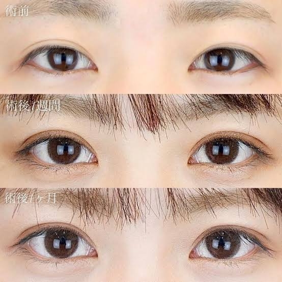 20代のうちにしておいた方がいい美容