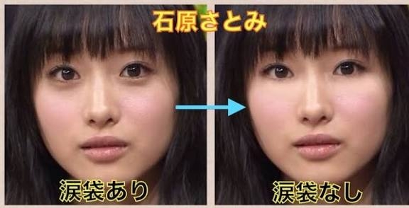 涙袋好きな人(メイクやヒアルの話)