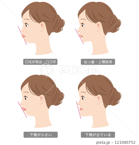 50代からの歯列矯正