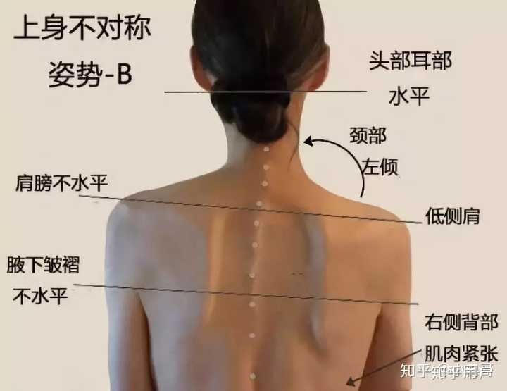 肩の高さが違う人