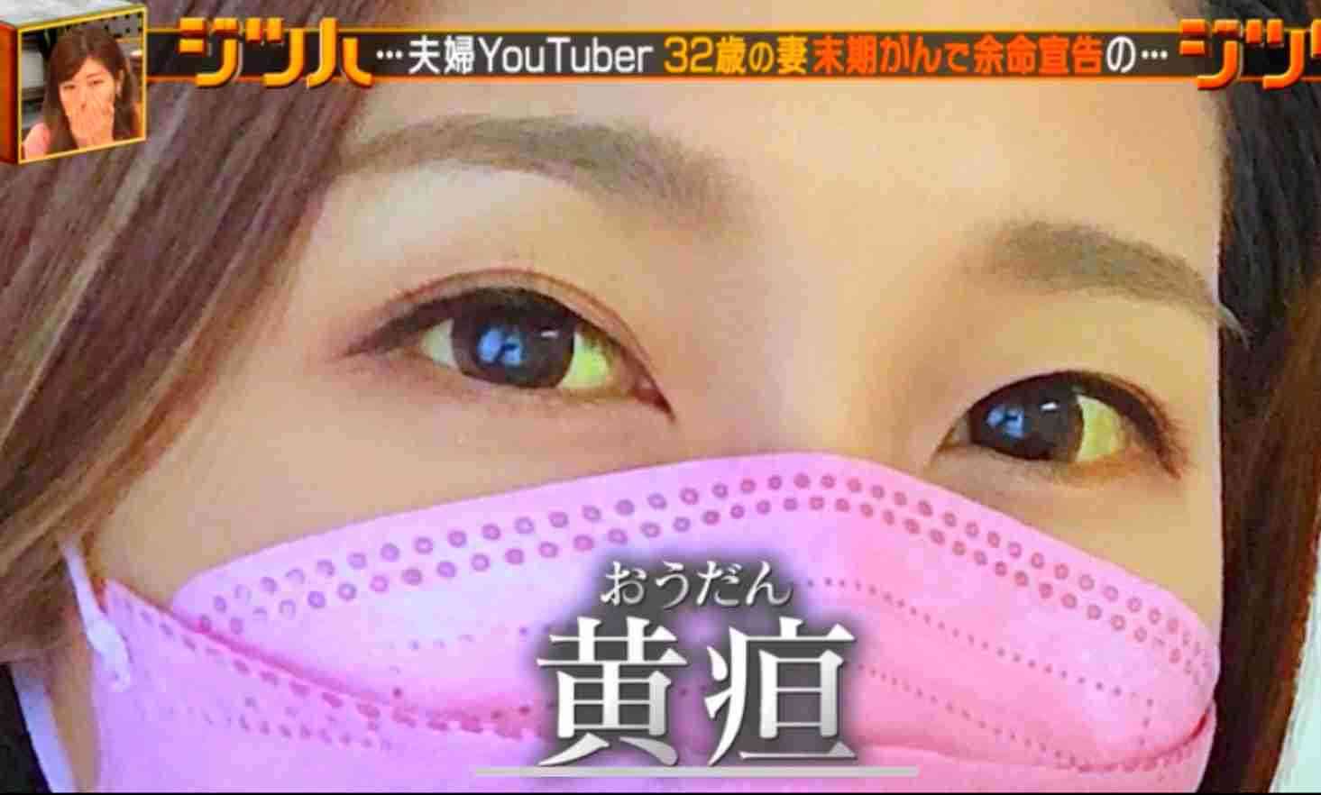 話に矛盾が多い人