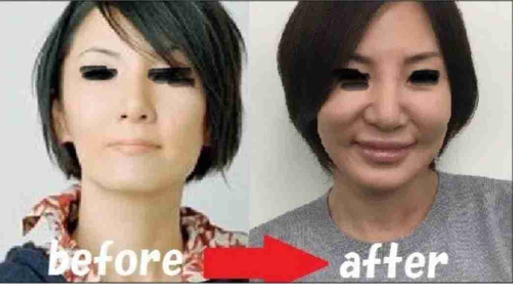 梨花 オトナの美容祭でヒアルロン酸注入を語る「入れ過ぎて、ちょっと違って」