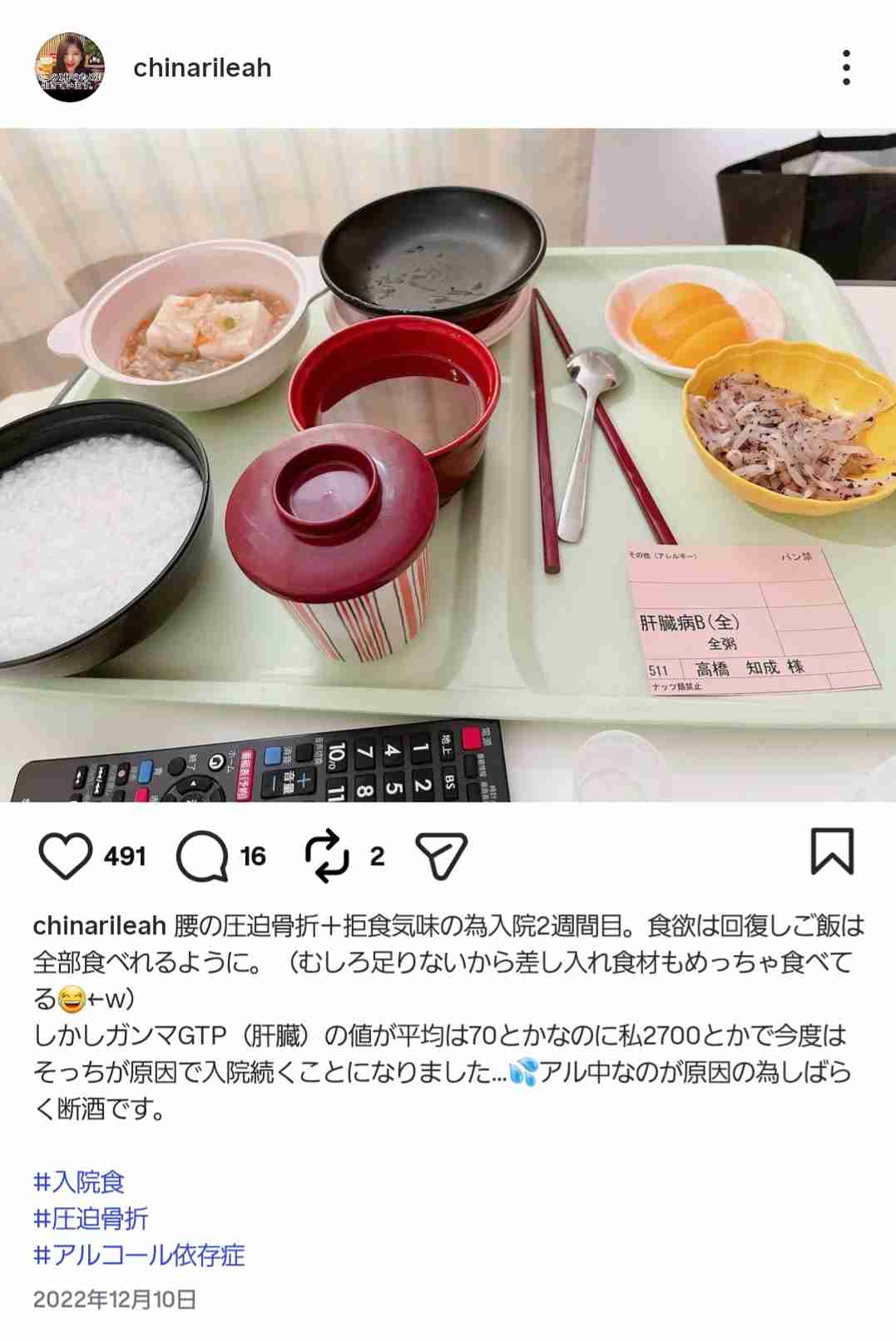 大食い双子姉妹Youtuber「はらぺこツインズ」活動休止の病名を公表…「長年患っている病気」も明かす