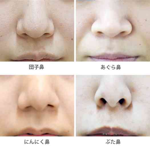 鼻の穴