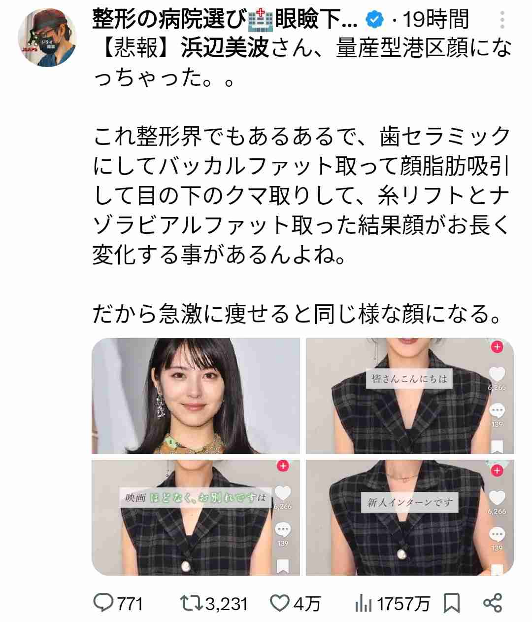 浜辺美波　最新近影のフェイスライン“ほっそり激変”に心配の声も…『24時間テレビ』から続く、多忙への懸念