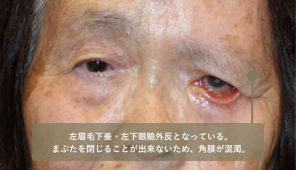 IKKO、「末梢神経の顔面まひ」で緊急入院していた「眉毛の位置が2、3センチずれて…」退院と仕事復帰を報告