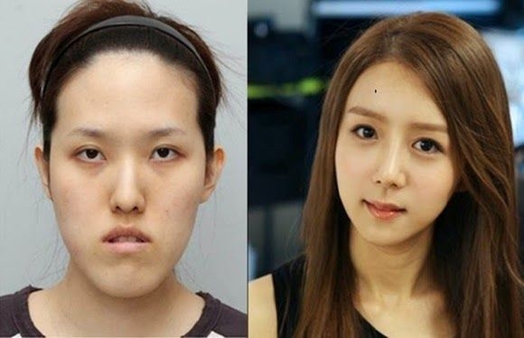 美容最大限努力したことあります？
