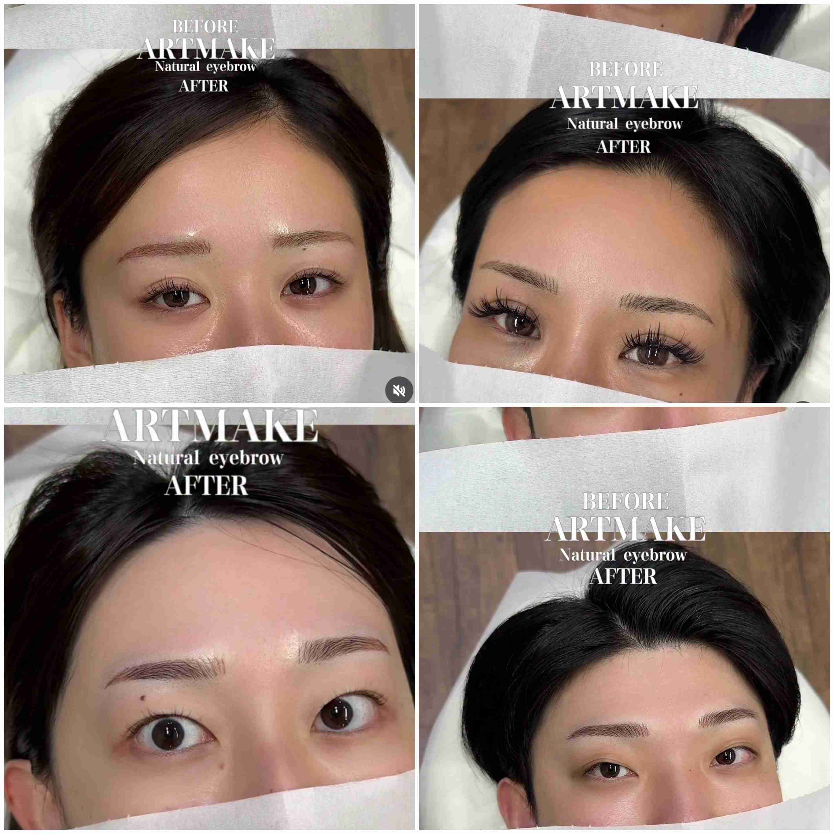 【独自】無資格「アートメイク」警察に相談を！厚労省が自治体に通知　美容後遺症外来の医師「医療の枠の中でやること大事」
