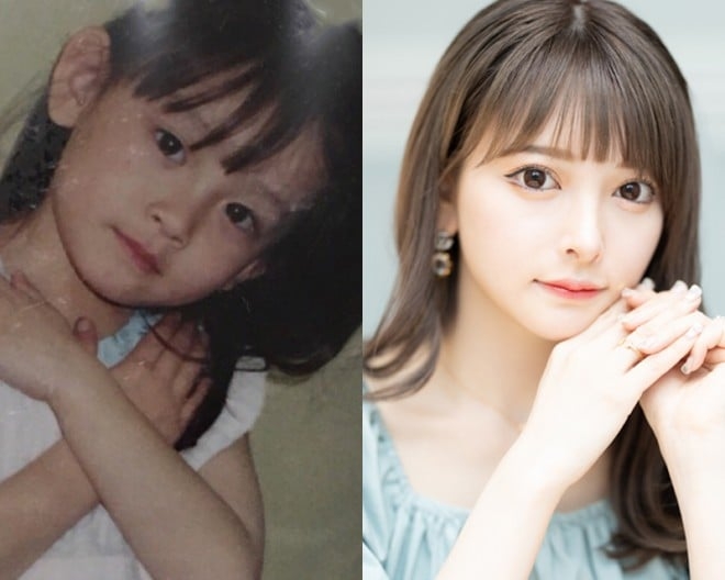 整形してる人、身近にいますか？