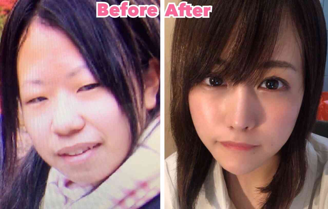 整形してる人、身近にいますか？