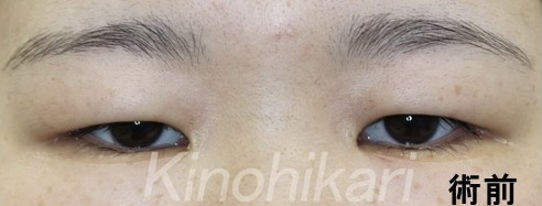 美人かブスかを決める上で一番大事なパーツって何かな？