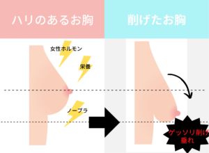 垂れ乳仲間