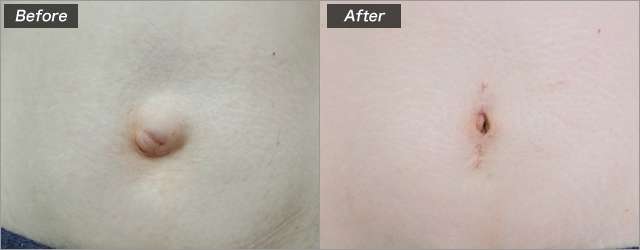 元HKT48宮脇咲良、AKB48は「努力し続けることを教えてくれた場所」20周年記念コンにメッセージ 現在はLE SSERAFIMとして活躍