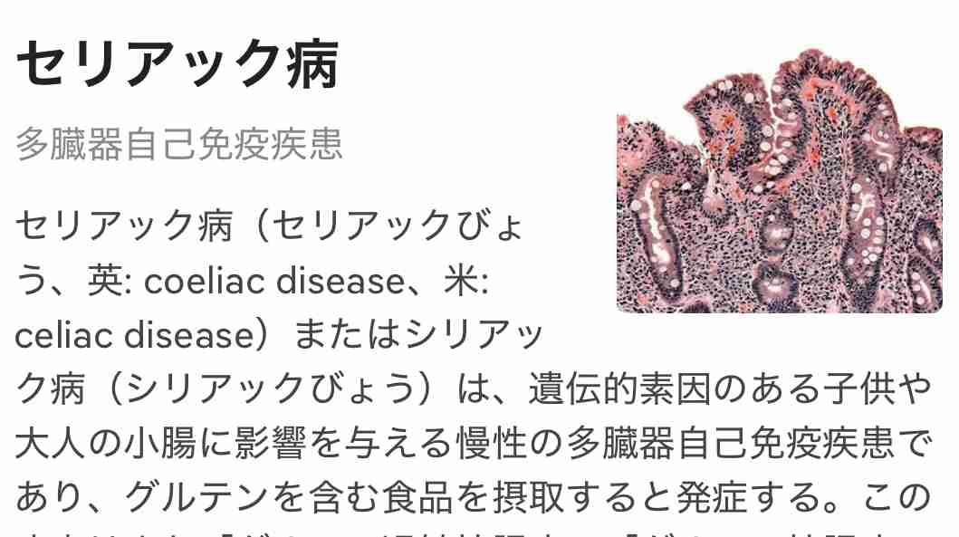 コメ価格は「損切り」間近か　卸最大手・神明社長の「暴落」発言の真意とは　「5キロ3500円」は実現するか