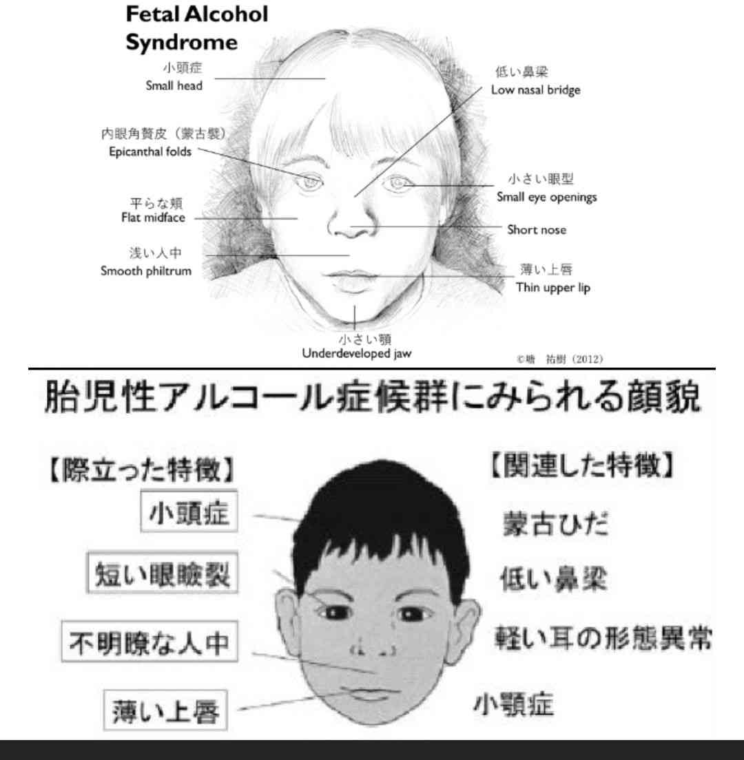 「“奴隷同然の扱い”を受けてきた」軽度知的障害(IQ60)の25歳女性を直撃「家庭を持つのが怖かったけど…」結婚に踏み切るまで
