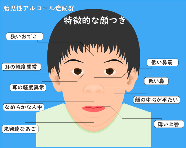 「“奴隷同然の扱い”を受けてきた」軽度知的障害（IQ60）の25歳女性を直撃「家庭を持つのが怖かったけど…」結婚に踏み切るまで