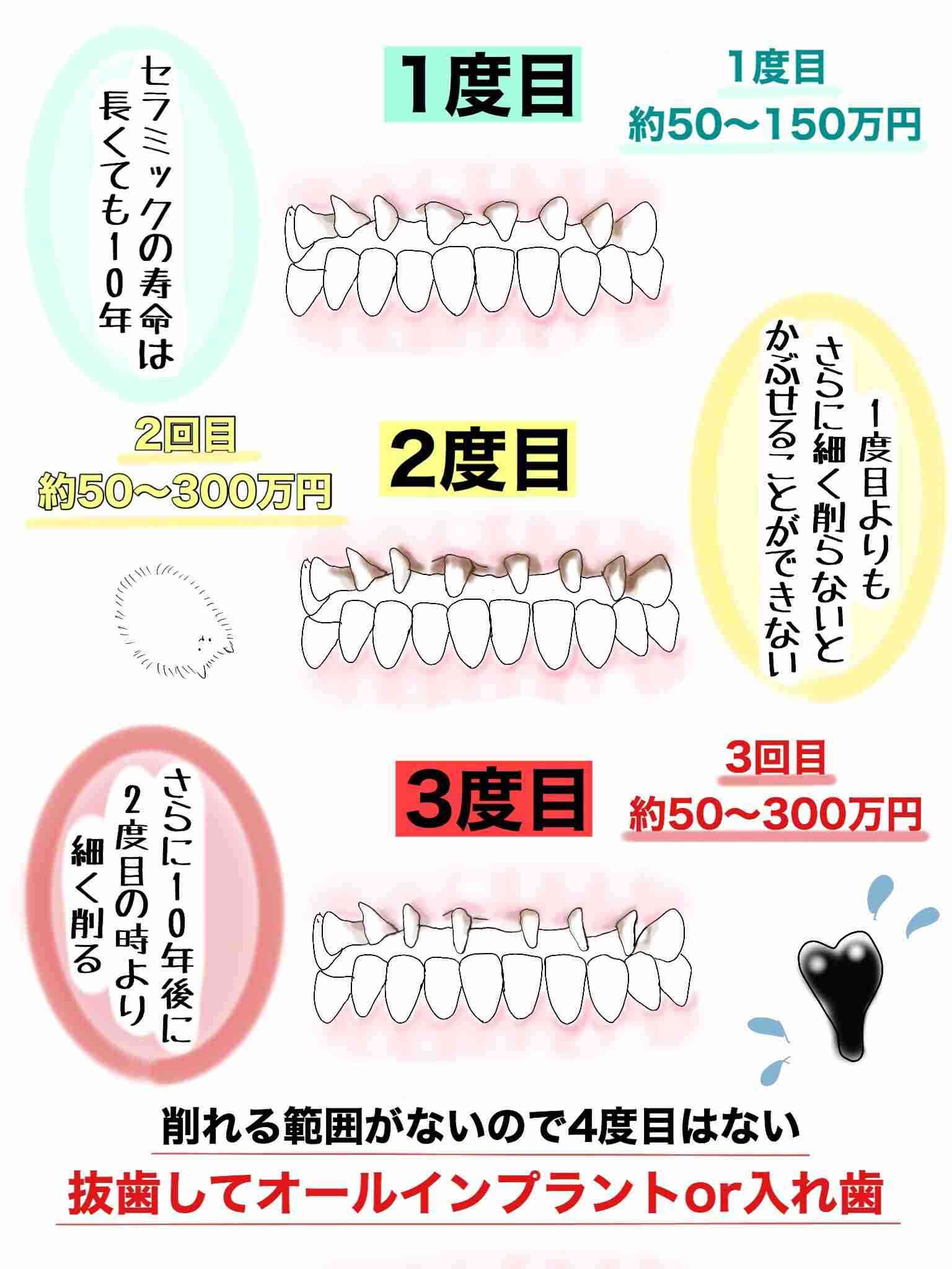 保険適用で根管治療した方、治療中の方