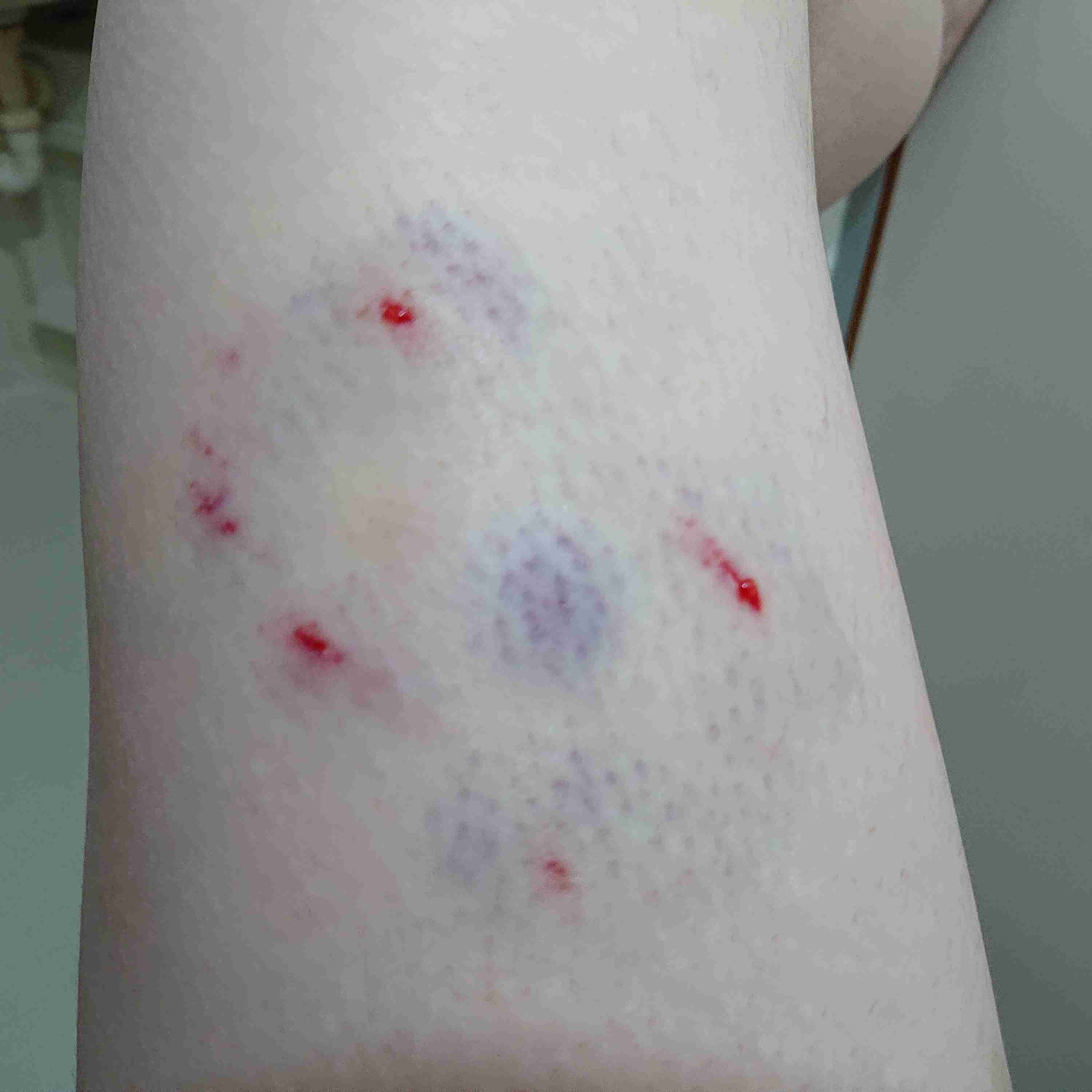 甲斐犬２匹逃走、通行人かまれる　沖縄・石垣島