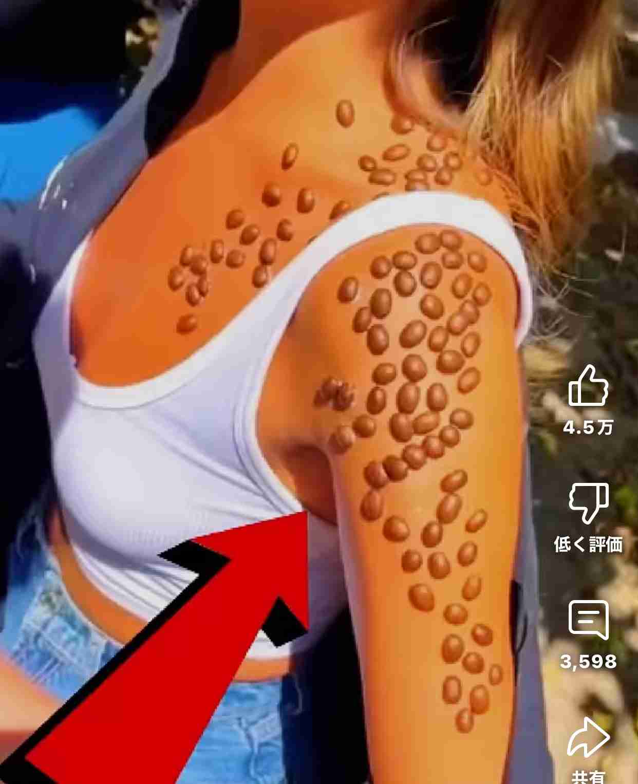 【閲覧注意】色んな集合体の画像を集めようPart6